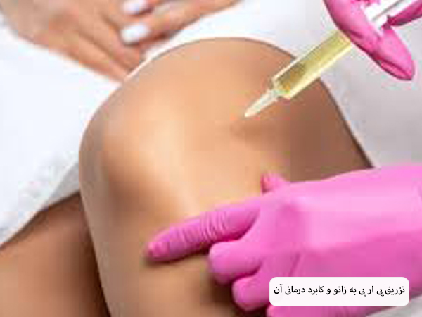 محتویات محلول پی آر پی. در پس زمینه سفید.