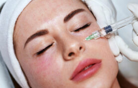 مزوتراپی صورت یک خانم جوان.