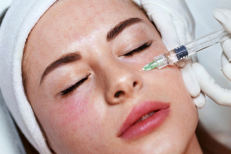 مزوتراپی صورت یک خانم جوان.