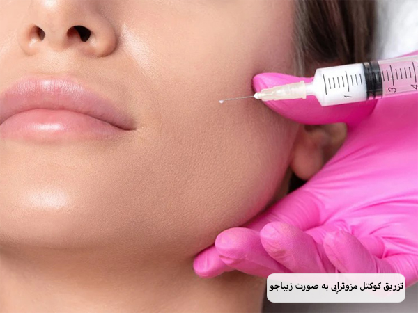 انجام مزوتراپی روی صورت یک خانم جوان.