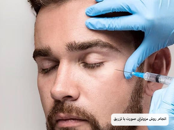 تزریق کوکتل مزوتراپی به صورت یک آقای جوان.