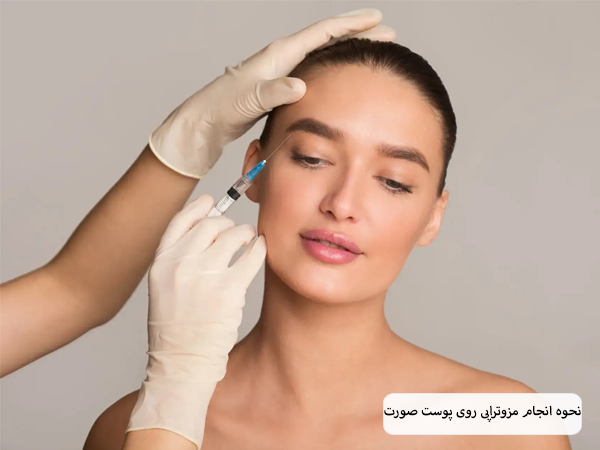 انجام مزوتراپی روی صورت زیباجوی جوان