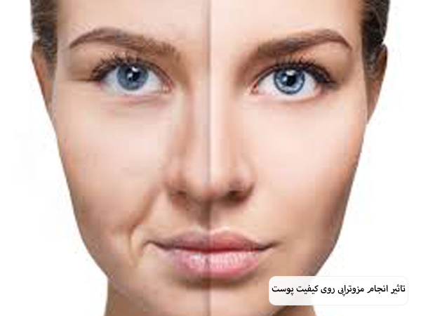 صورت یک خانم قبل و بعد از انجام مزوتراپی در پس زمینه سفید.