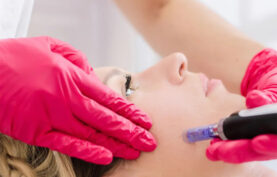 انجام پی آر پی روی پوست صورت یک خانم.