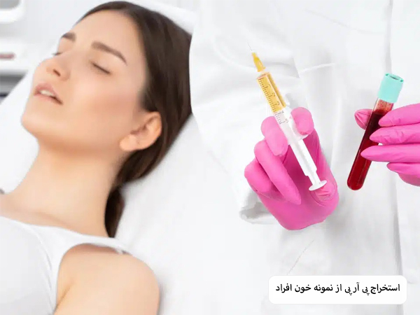 پزشکی که با گرفتن یک عدد نمونه خون و محلول پی آر پی در کنار زیبا جو.