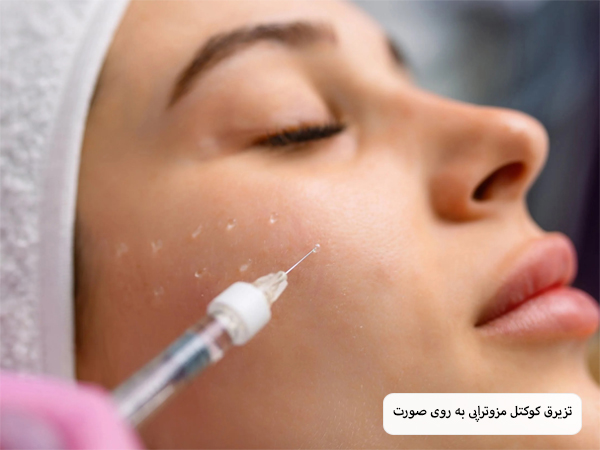 چند نمونه نخ لیفت مختلف که به صورت ردیفی در کنار هم قرار گرفته اند با پس زمینه سفید.