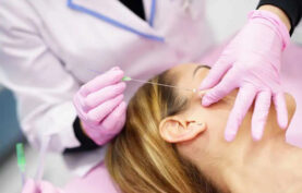 لیفت صورت یک خانم جوان با نخ توسط پزشک.