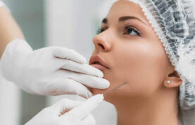 لیفت صورت یک خانم جوان با نخ لیفت.