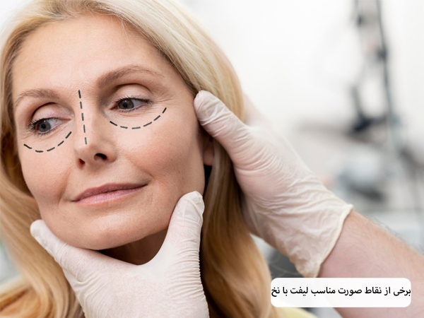 پزشک صورت زیبا جو را قبل از لیفت با نخ علامت گذاری کرده است.