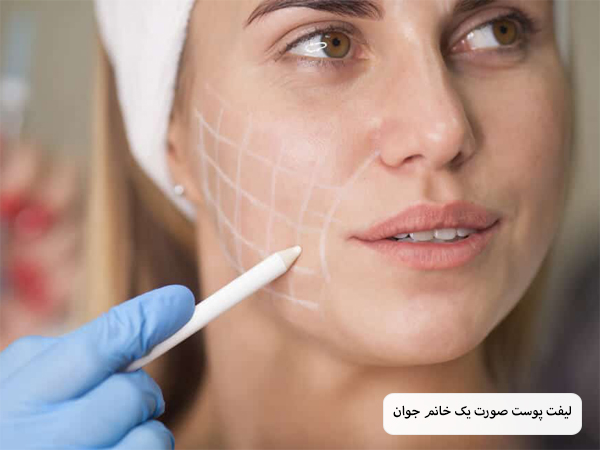 مراحل اولیه لیفت پوست با نخ که پزشک در حال انجام روی صورت یک خانم جوان است.