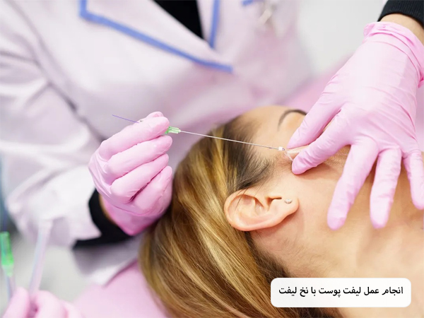 پزشک درحال انجام لیفت گونه زیبا جو با استفاده از نخ لیفت.