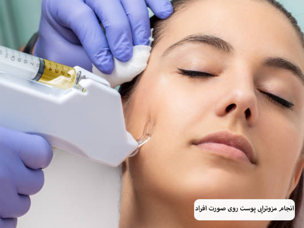 انجام مزوتراپی روی صورت یک خانم جوان با دستگاه های مدرن.