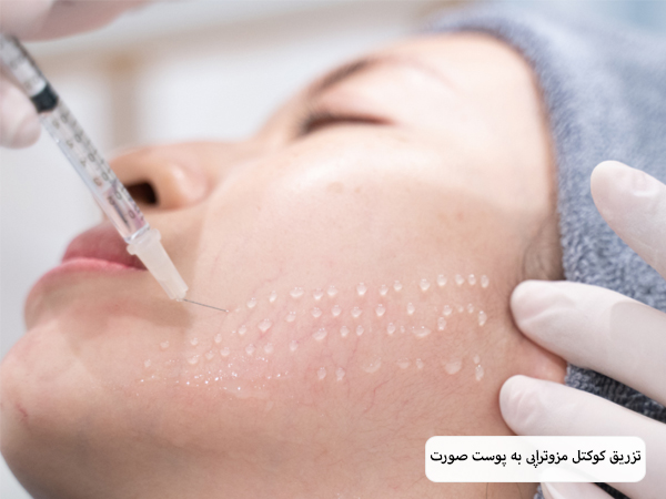 تزریق کوکتل مزوتراپی به صورت یک زیباجو.