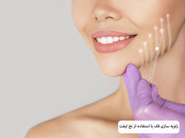 لیفت صورت یک خانم با نخ لیفت.