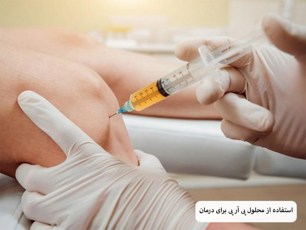 تزریق پی آر پی به زانوی یک فرد توسط پزشک.