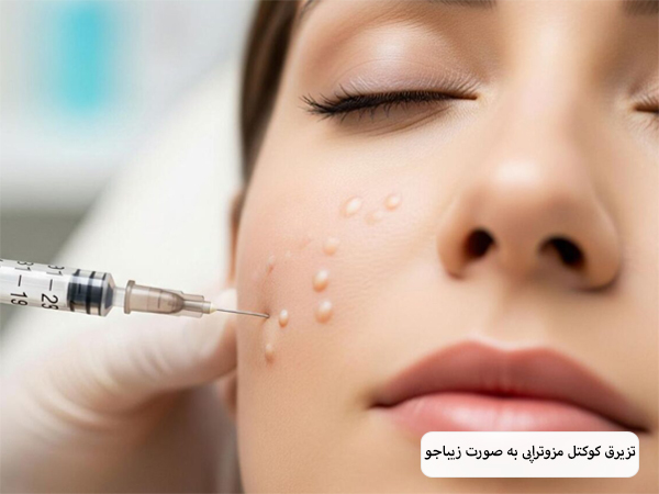 تزریق کوکتل مزوتراپی به صورت یک خانم جوان.